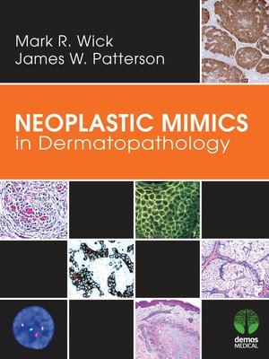 cover image of Neoplastic Mimics in Dermatopathology